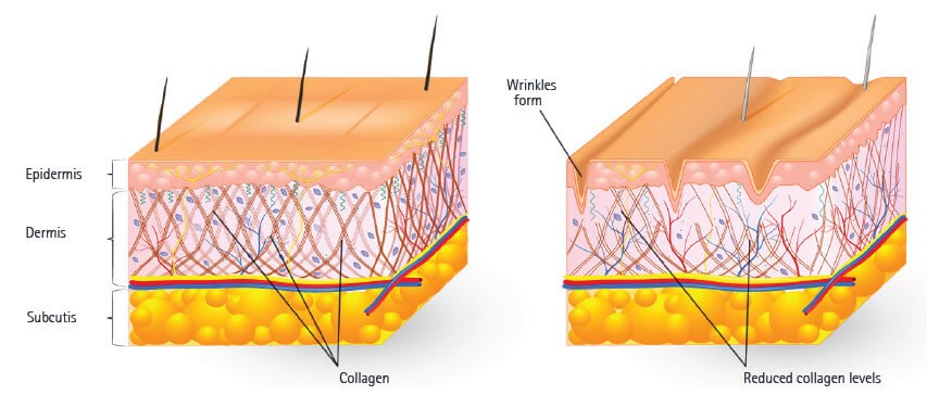 Collagen Peptides Skin Care | Plumping Up Your Sagging Wrinkly Skin